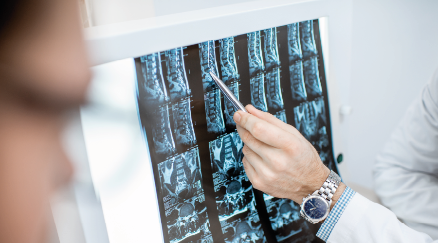 Skolyozun erken tanısı için takip önerisi