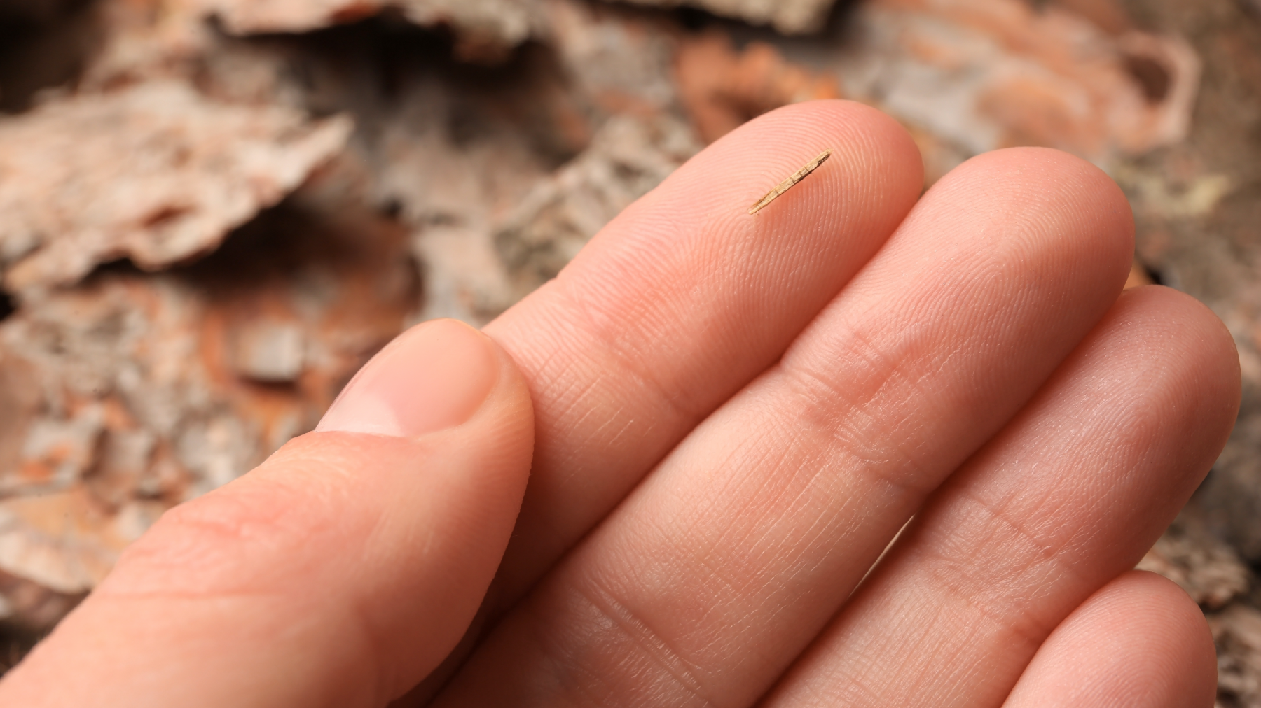 Elinize kıymık battığında kolayca nasıl çıkarılır?